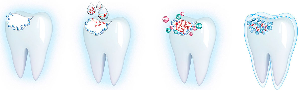 Ночные кормления и кариес у ребенка: можно ли кормить ночью?