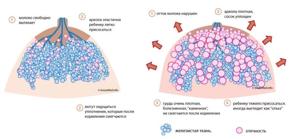 13 способов усилить лактацию