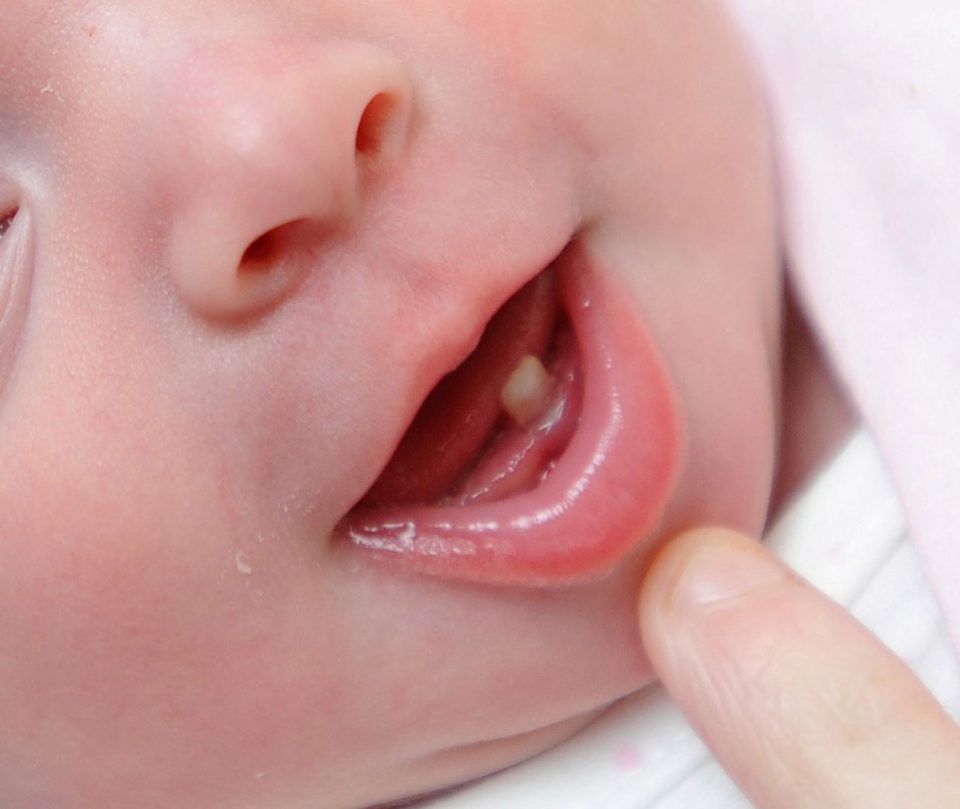 При прорезывании зубов у ребенка поднялась температура