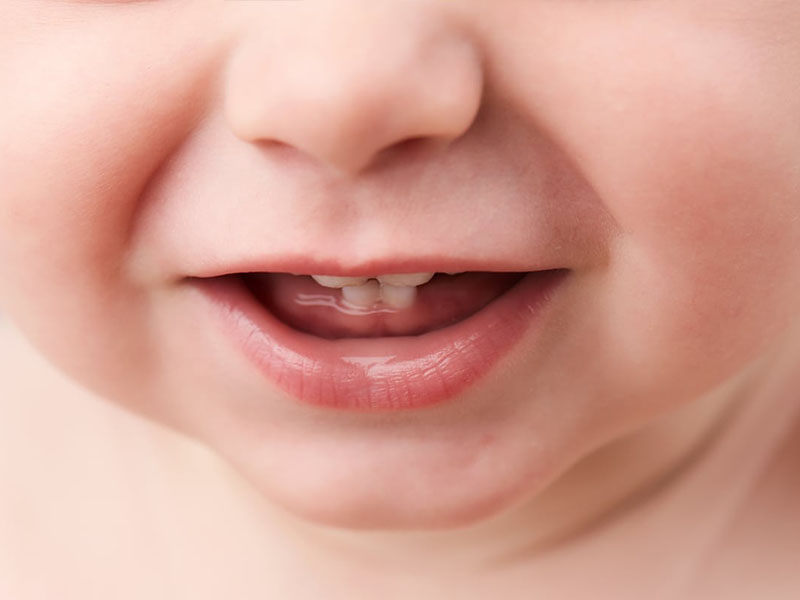 Как облегчить боль при прорезывании зубов у ребенка | нурофен®