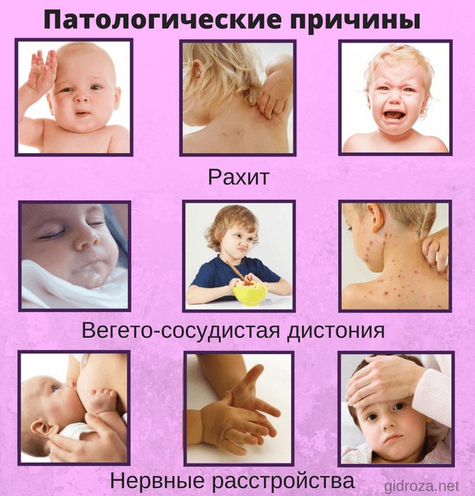 Потеет голова у грудничка во время кормления и сна: возможные причины :: syl.ru