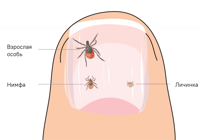 10 главных ошибок при защите от клещей