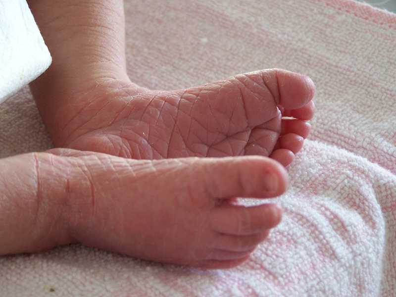 Боль в ногах у ребенка - медицинский центр «эхинацея»