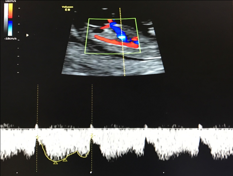 Советы беременным (2 триместр)