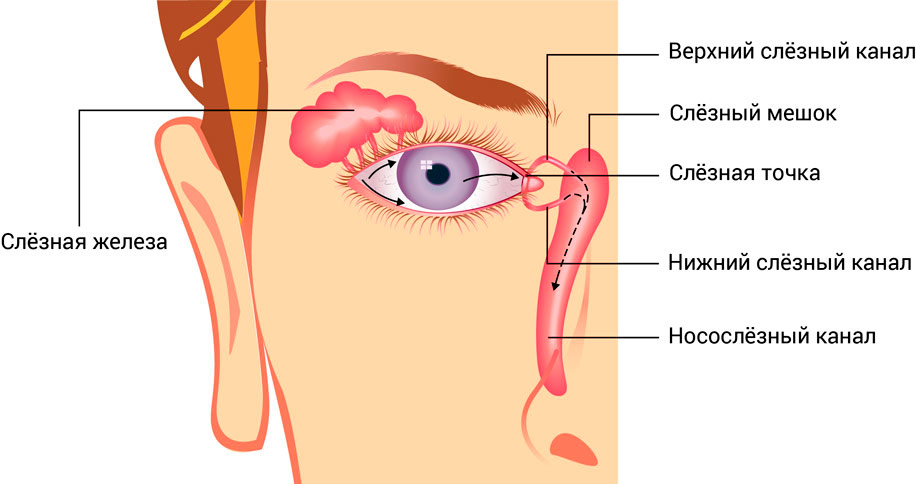 Зондирование слезного канала у новорожденных
