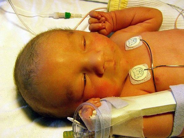 Почему в роддоме у новорожденных берут кровь из пятки: опасно ли это