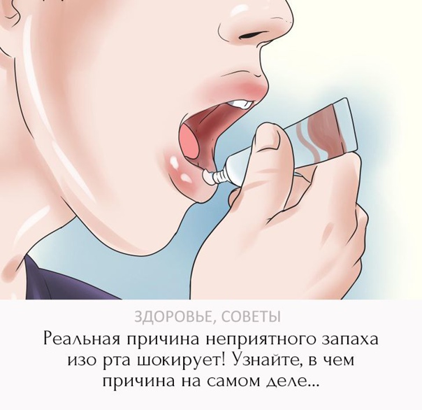Влияние covid-19 на полость рта | стоматология элитдентал м.
