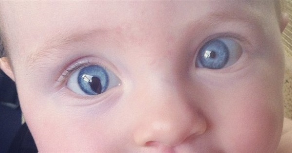 Почему у новорожденного один глаз открывается больше другого
