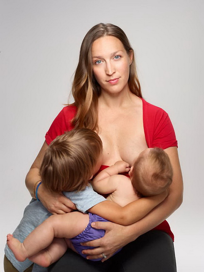 Гипопластические аномалии молочных желез: гипоплазия – недоразвитие груди. часть 1