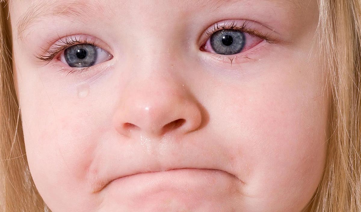 Чем протирать глазки новорожденному — основные правила ухода за глазами