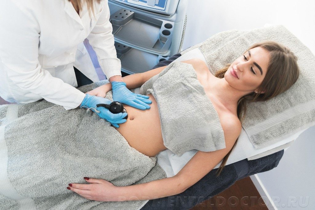 Как вернуть плоский живот после родов за 1 месяц? 3 хитрости