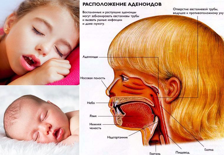 Заложен нос: причины, симптомы, лечение. что делать, когда у ребенка постоянно заложен нос?