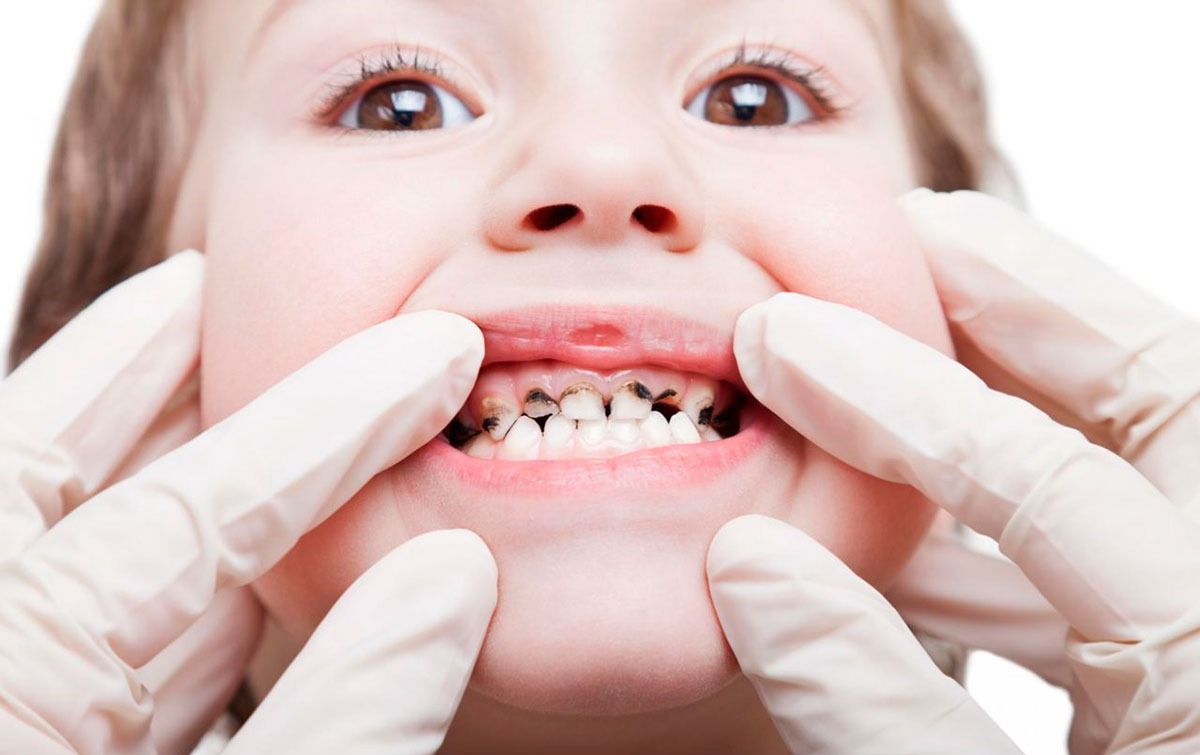 Ребенок и стоматолог: как настроить ребенка и успешно вылечить зуб