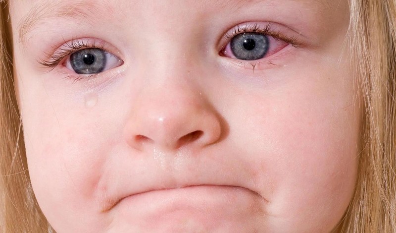 Чем протирать глазки новорожденному — основные правила ухода за глазами