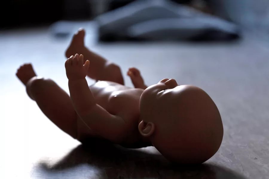 Птоз верхнего века у новорожденных: причины и лечение