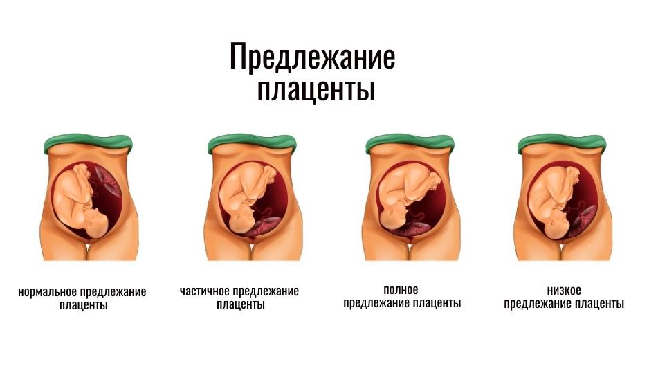 31 неделя беременности