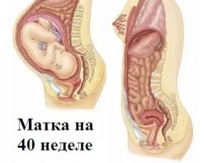 Является ли загиб матки проблемой при беременности