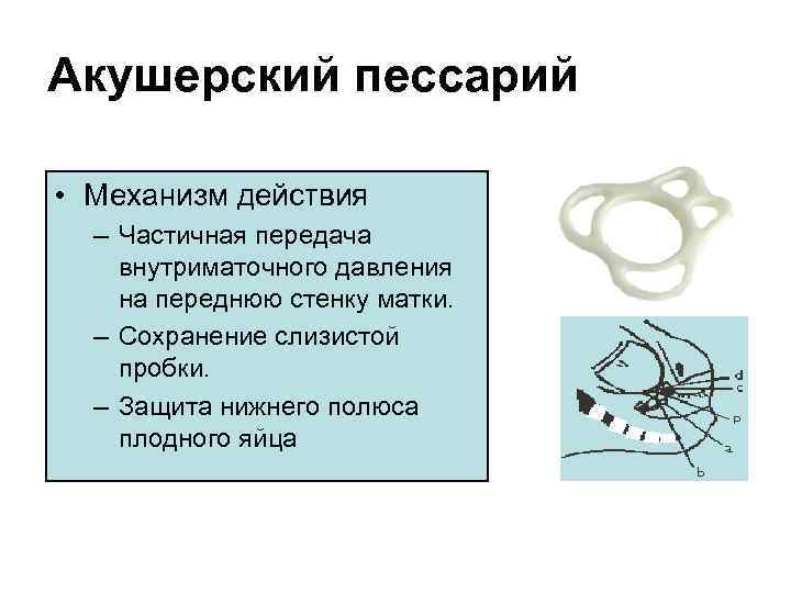 Установка и удаление пессария в москве в медицинском центре «клиника abc»
