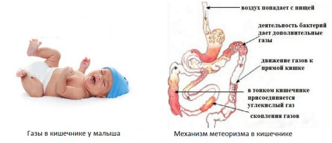 Колики у младенцев - советы доктора педиатра. что делать при младенческих коликах? :: ацмд