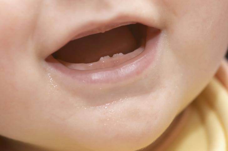 Прорезывание коренных зубов у детей