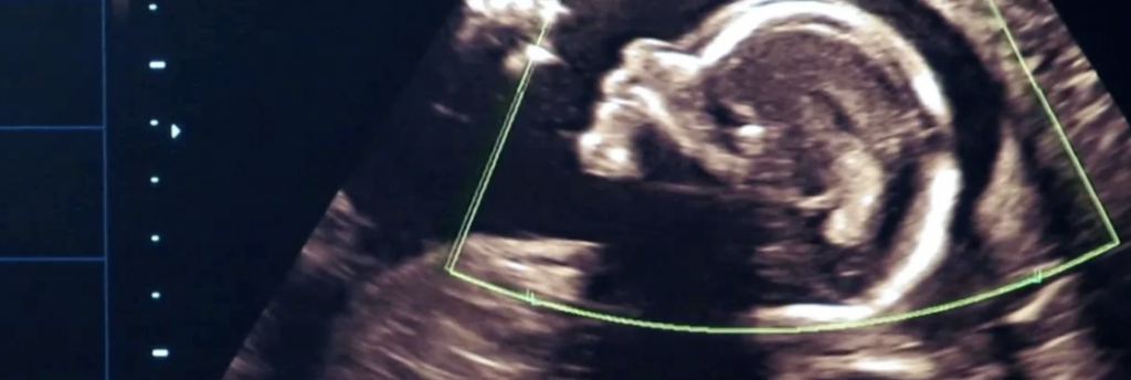 Признаки беременности на 3 неделе