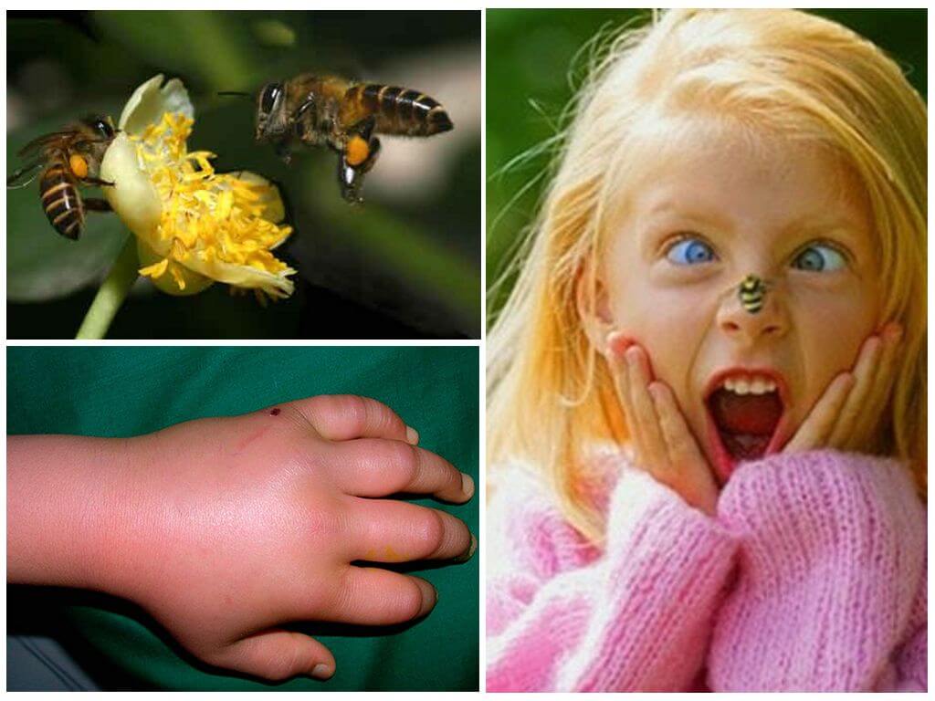Ребенок давит насекомых: возможные причины и способы решения проблемы, советы психологов