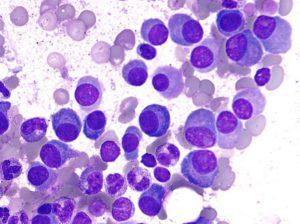 Плазматические клетки в крови у ребенка по результатам анализа