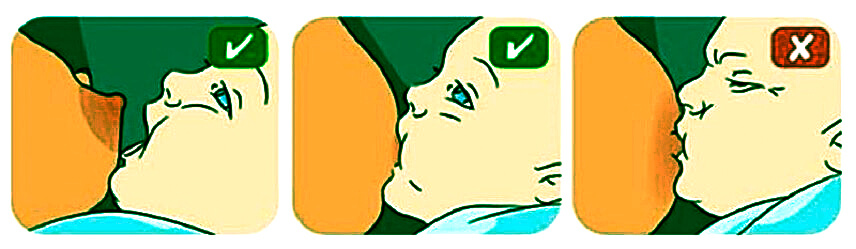 Правильное прикладывание ребенка к груди