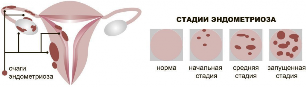 Здоровая беременность – здоровый ребенок!