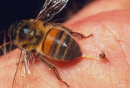 Что делать, если ребенка покусали комары, мошки, пчелы, осы – первая помощь при укусах насекомых