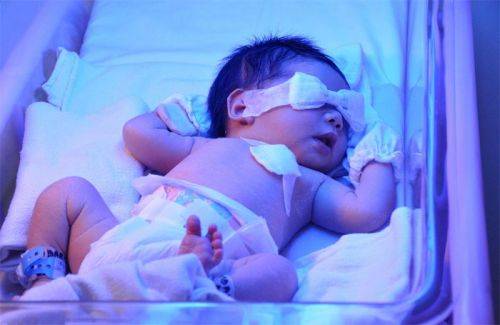 Пограничные состояния новорожденных: краткое описание