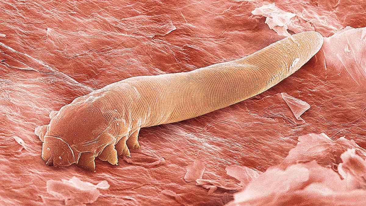 Красные глаза у ребенка — виды покраснений, причины, симптомы