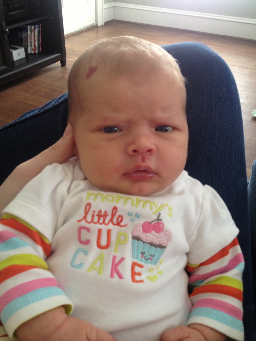 Почему родинка у ребенка растет на теле, лице — что делать