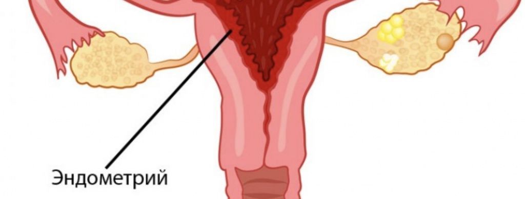 Актовегин при планировании беременности
