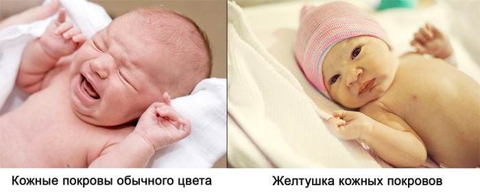 Первый вдох. неонатолог о том, когда новорожденным нужна экстренная помощь | общество | аиф хабаровск