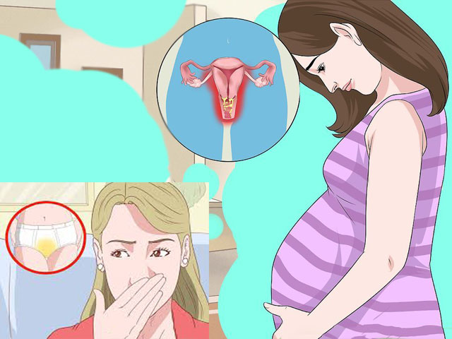 Молочница во время беременности | nutrilak