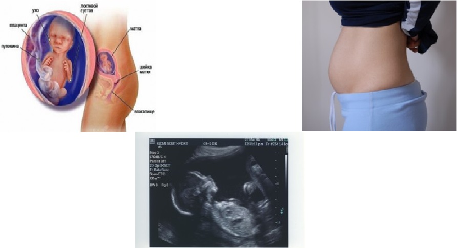 17 неделя беременности - второй скрининг, что происходит с малышом, фото животиков, давление и анемия, йога