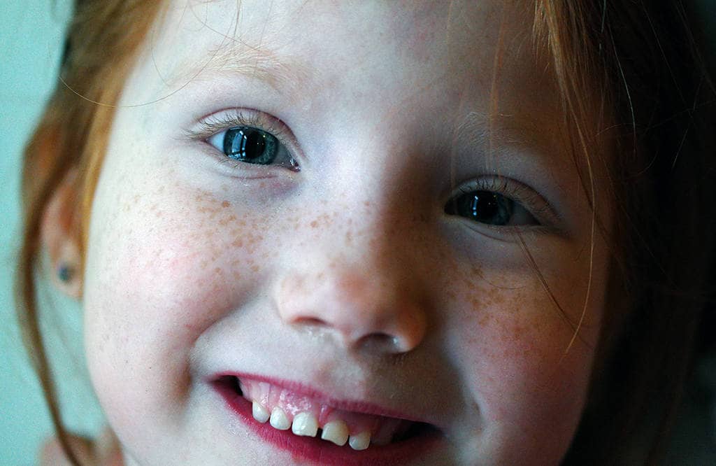 Ребенок ест много сладкого