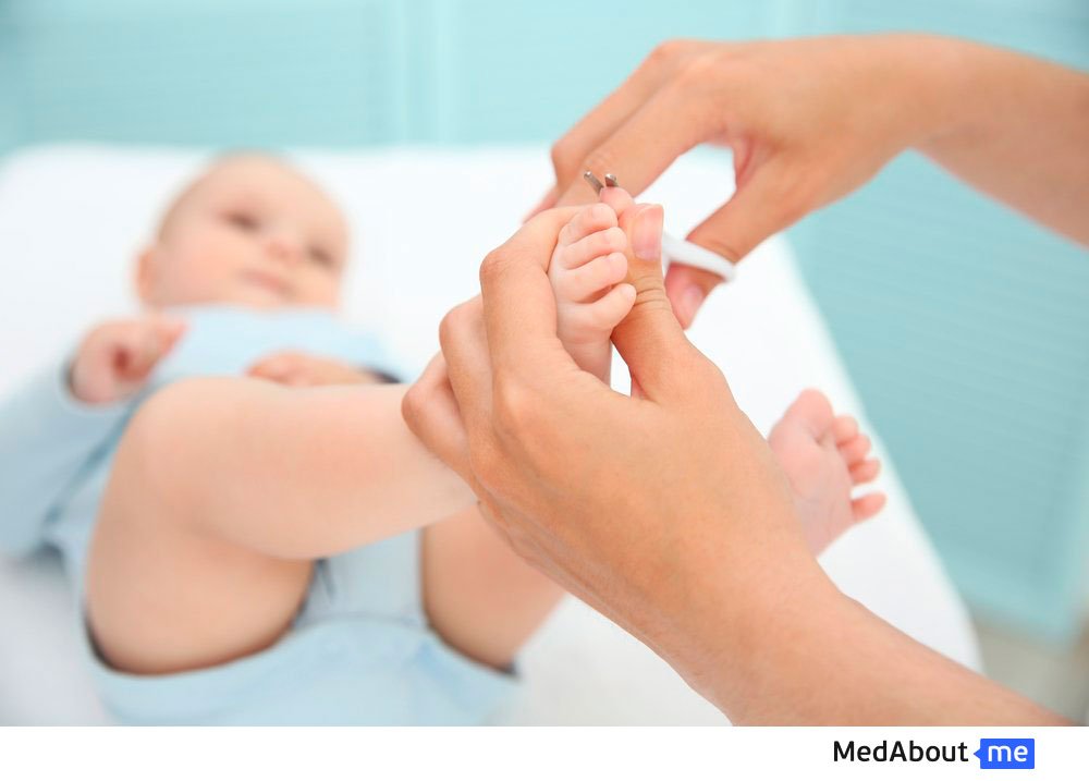 Ногти новорожденного. как подстричь ногти ребенку, как за ними ухаживать