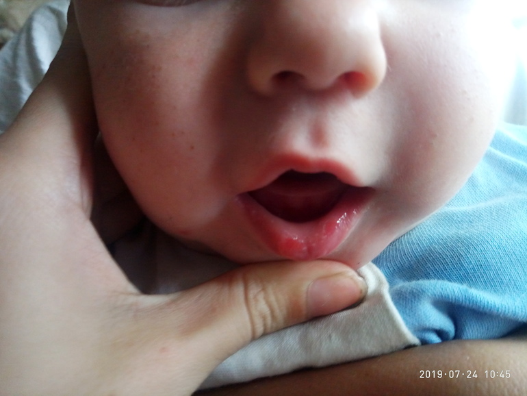 По какой причине у новорожденного трясется нижняя губа?