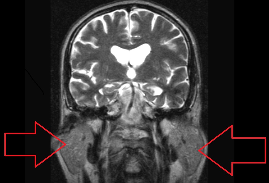 Головная боль у ребенка — постоянная, периодическая, причины