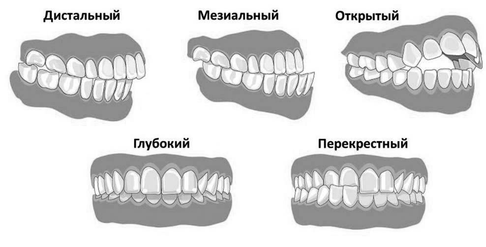 Что делать, если ребенок кривляется?