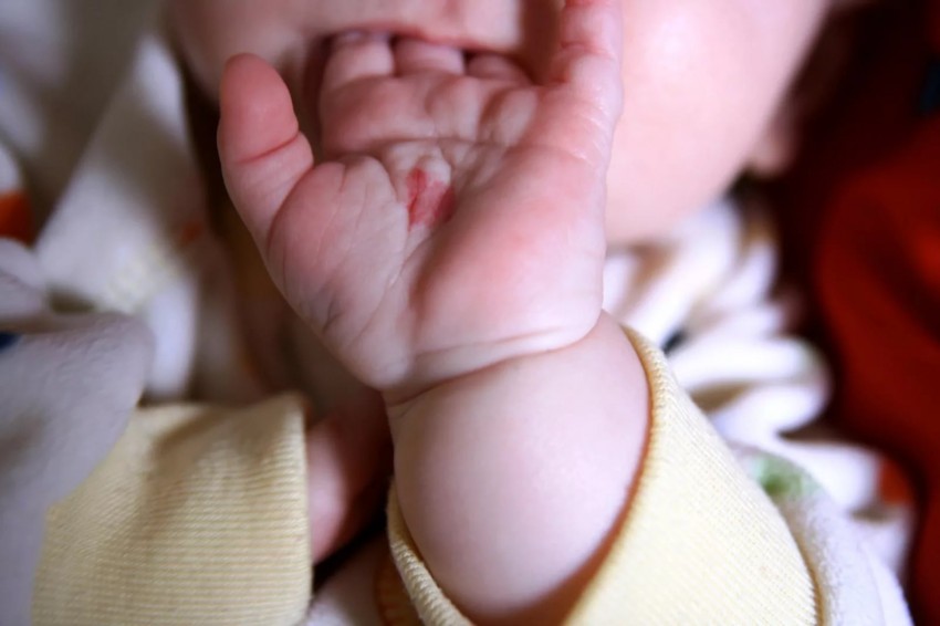 Почему родинка у ребенка растет на теле, лице — что делать