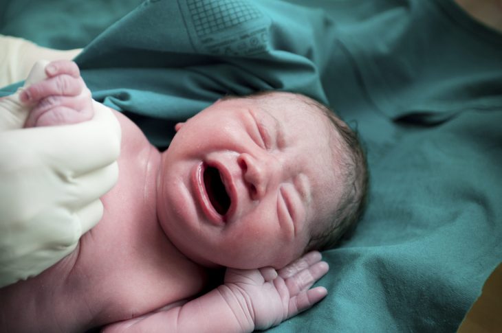 Шкала Апгар – оценка жизнеспособности новорожденного