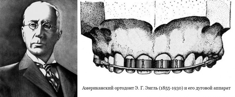 Могут ли в 2 месяца резаться зубы у грудничков