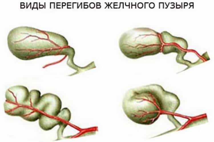 Дистрофия печени. причины, симптомы и лечение!