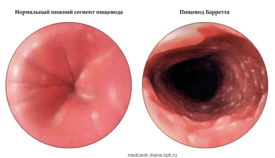 Алоэ при беременности: друг или враг