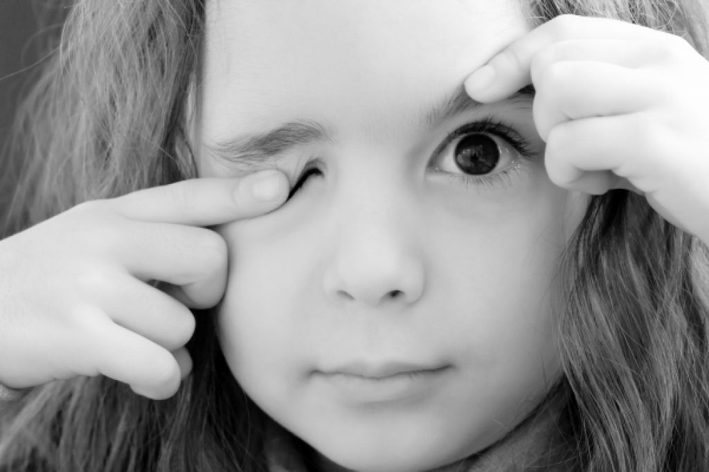 Нервный тик глаза у взрослых: причины и лечение