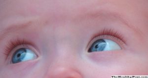 Синий носогубный треугольник у новорожденного — причины посинения