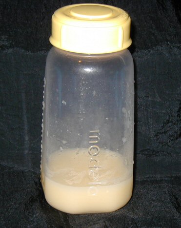 Лактостаз (застой молока)